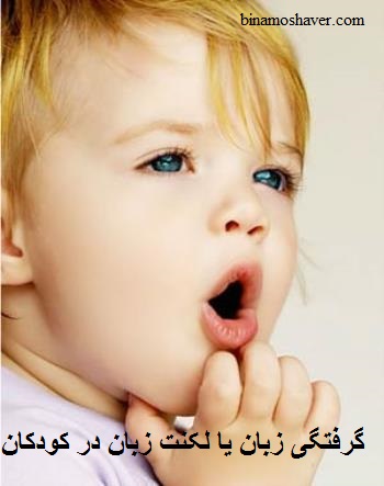 گرفتگی زبان یا لکنت زبان در کودکان