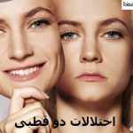 اختلالات دو قطبی